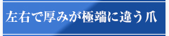 左右で厚みが極端に違う爪